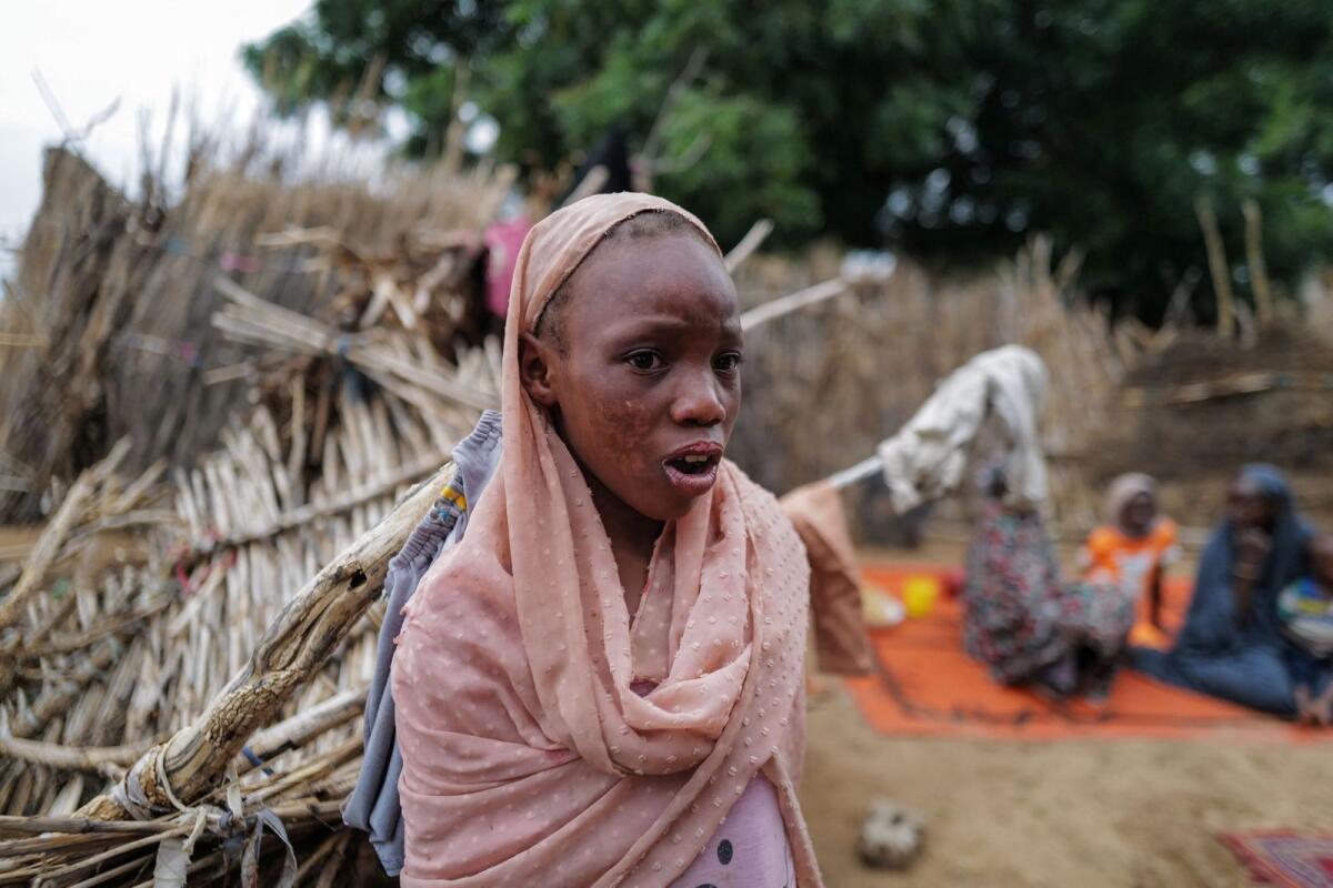 مآب، 12 عاما، فتاة سودانية فرت من الصراع في الجنينة في منطقة دارفور بالسودان، والتي قالت إنها فقدت والديها وأصيبت بحروق على وجهها بعد سقوط قذيفة هاون على منزلها، في الصورة في ملجأ مؤقت في أدري. تشاد، في 24 يوليو 2023. – ملف رويترز